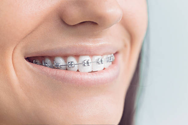 Best Teeth Whitening  in Aberdeen, MS